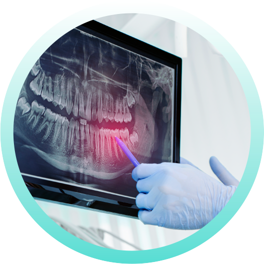 3Beam Teeth Scan