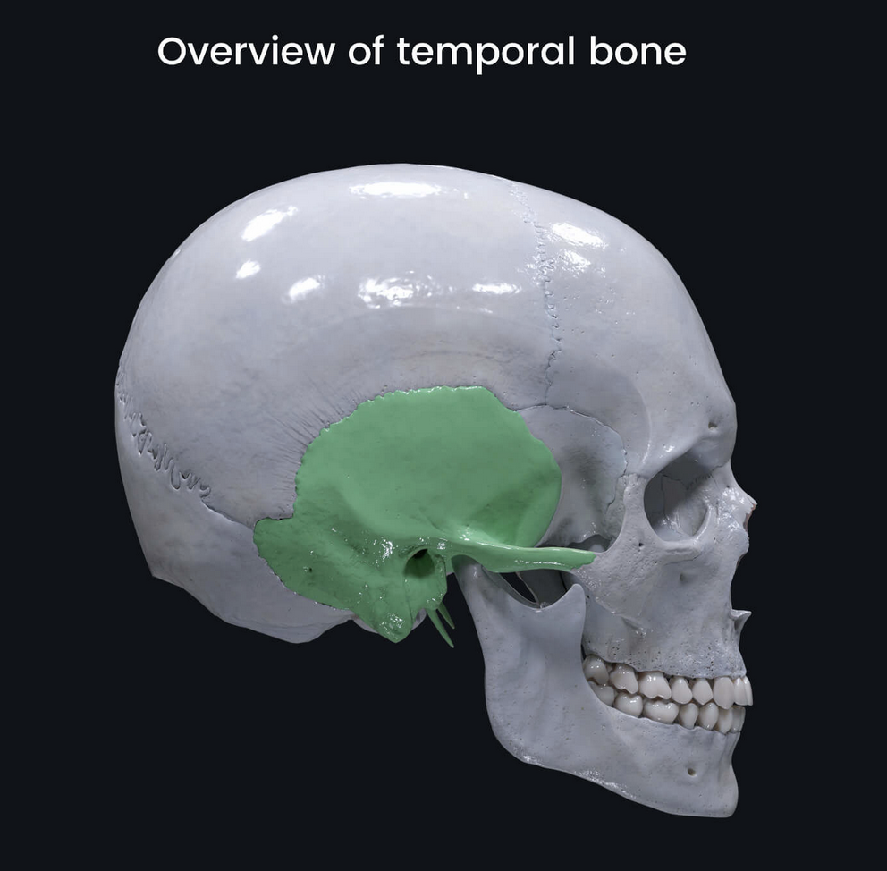 Temporal bone CT - 3Beam