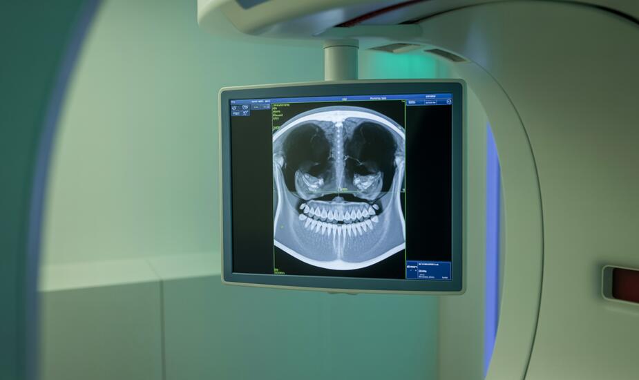 CBCT odontogenic sinusitis imaging showing maxillary sinus and dental pathology at 3Beam Harley Street