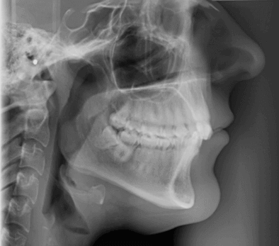 Radiographic Cephalometry 歯科　本　矯正 Radiographic Cephalometry 歯科 本 矯正 健康・医学
