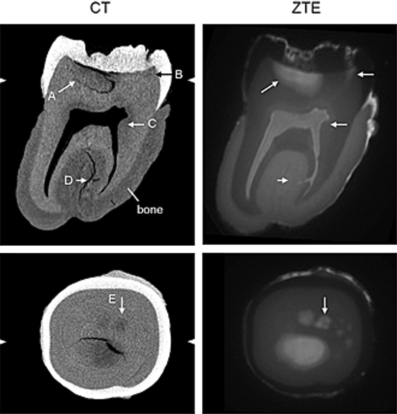 dental MRI images